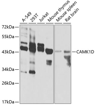 Anti-CAMK1D Antibody