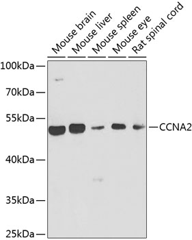 Anti-CCNA2 Antibody