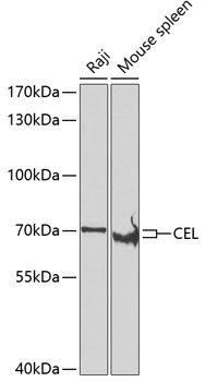 Anti-CEL Antibody