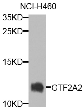 Anti-GTF2A2 Antibody