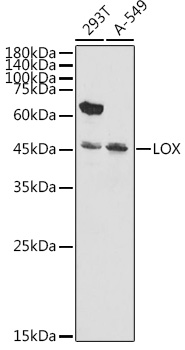 Anti-LOX Antibody