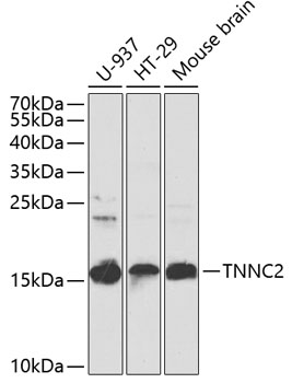 Anti-TNNC2 Antibody