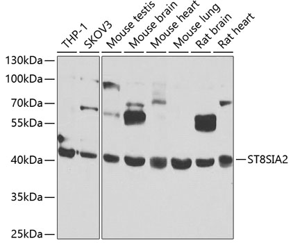 Anti-ST8SIA2 Antibody