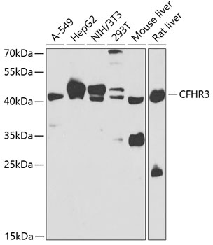 Anti-Complement factor H-related protein 3 Antibody