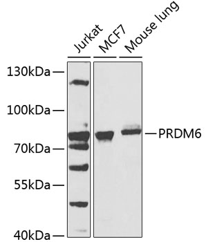 Anti-PRDM6 Antibody