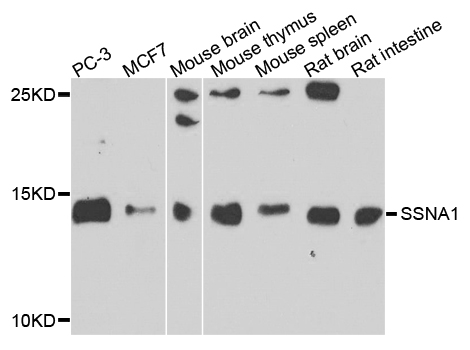 Anti-SSNA1 Antibody