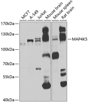 Anti-MAP4K5 Antibody