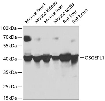 Anti-OSGEPL1 Antibody