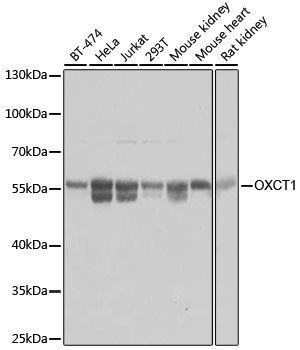 Anti-OXCT1 / SCOT Antibody