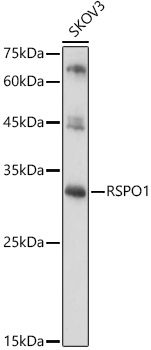 Anti-RSPO1 Antibody