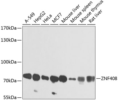Anti-ZNF408 Antibody