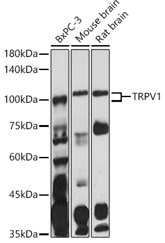 Anti-TRPV1 Antibody