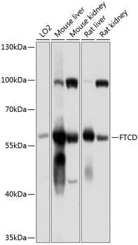 Anti-58K Golgi protein Antibody