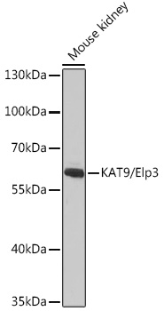 Anti-KAT9 / Elp3 Antibody