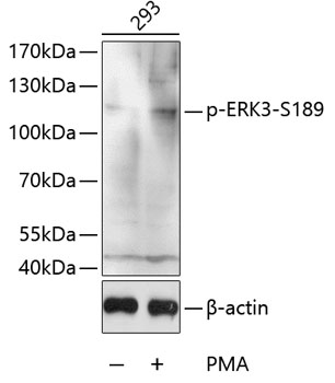 Anti-MAPK6 / ERK3 (phospho Ser189) Antibody