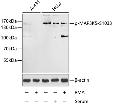 Anti-ASK1 (phospho Ser1033) Antibody