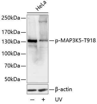 Anti-ASK1 (phospho Thr918) Antibody