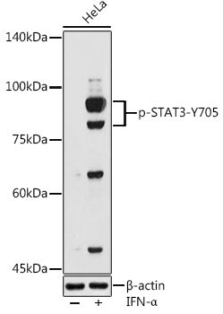 Anti-STAT3 (phospho Tyr705) Antibody