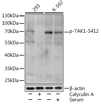 Anti-TAK1 (phospho Ser412) Antibody