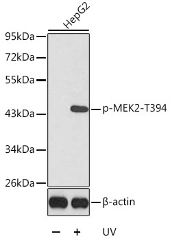 Anti-MEK2 (phospho Thr394) Antibody