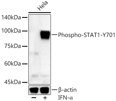 Anti-STAT1 (phospho Tyr701) Antibody