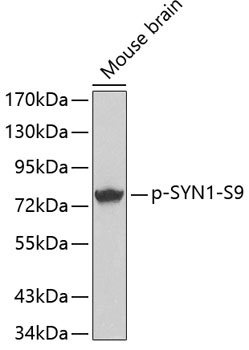 Anti-Synapsin I (phospho Ser9) Antibody - Identical to Abcam (ab194778)