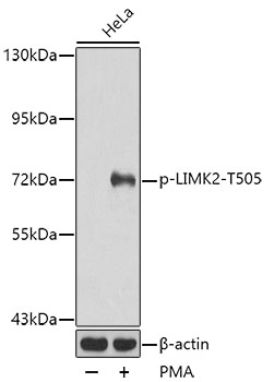 Anti-LIMK2 (phospho Thr505) Antibody - Identical to Novus (NB100-82023)