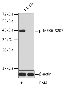 Anti-MKK6 (phospho Ser207) Antibody