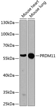 Anti-PRDM11 Antibody