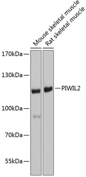 Anti-PIWIL2 Antibody