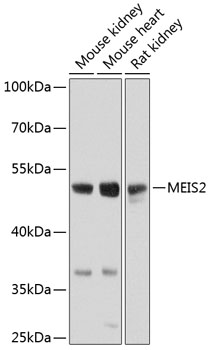 Anti-MEIS2 Antibody