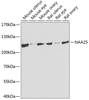 Anti-NAP1 (C12orf30) / p120 Antibody