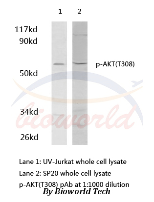 Anti-AKT (phospho-T308) Antibody