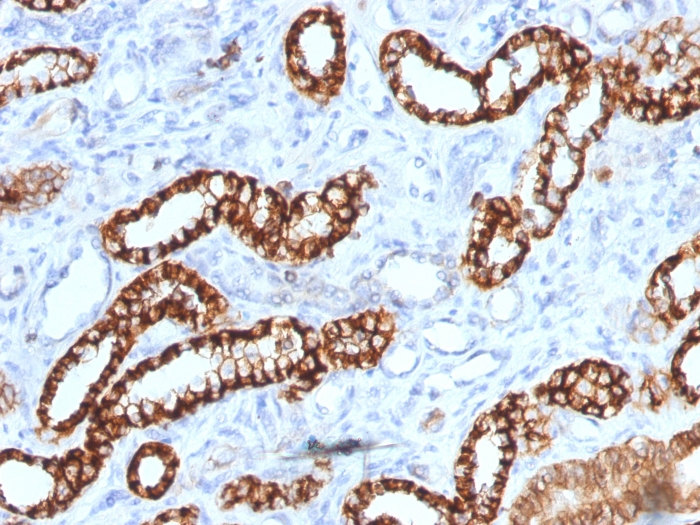 Anti-Cadherin 16 Antibody [rCDH16/1071]