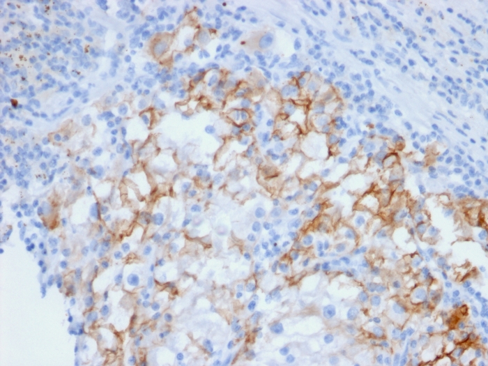 Anti-Cadherin 16 Antibody [CDH16/2448]