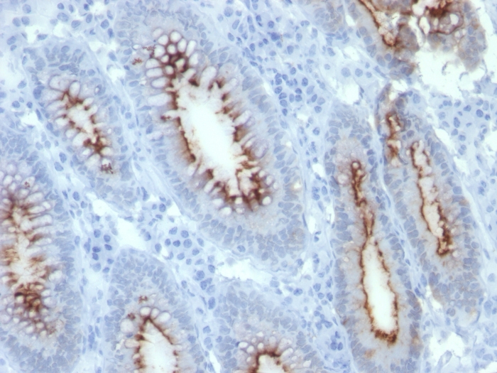 Anti-Carcinoembryonic Antigen Antibody [C66/261]