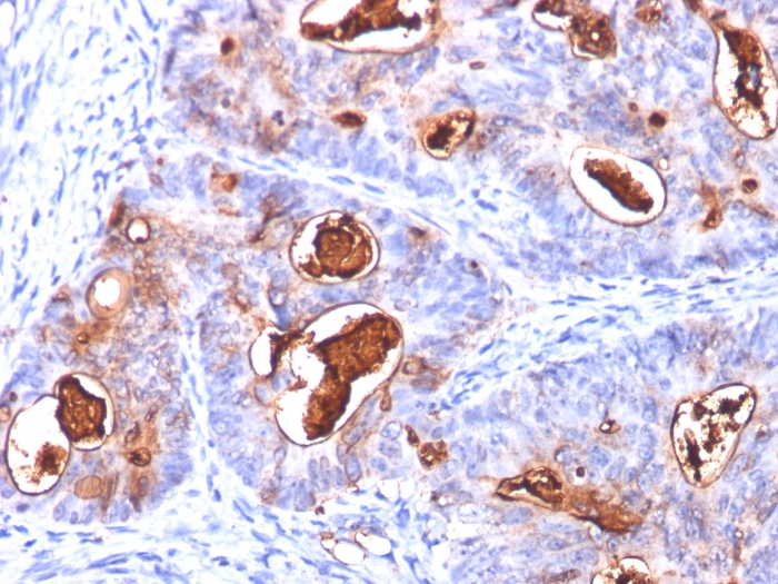 Anti-Carcinoembryonic Antigen Antibody [COL-1 + CEA31 + C66/261]