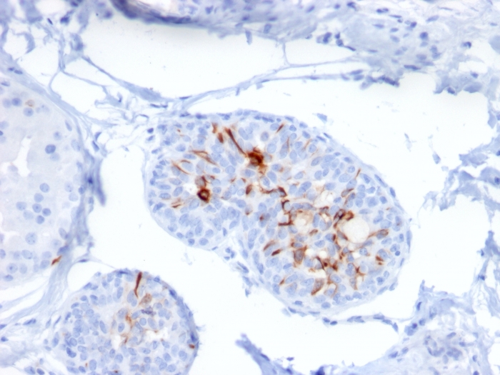 Anti-ZNF690 Antibody [ZSCAN29/2610]