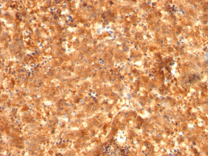 Anti-alpha Fetoprotein Antibody [C2 + C3 + MBS-12]