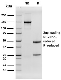 Anti-EGFR Antibody [rGFR/1667]