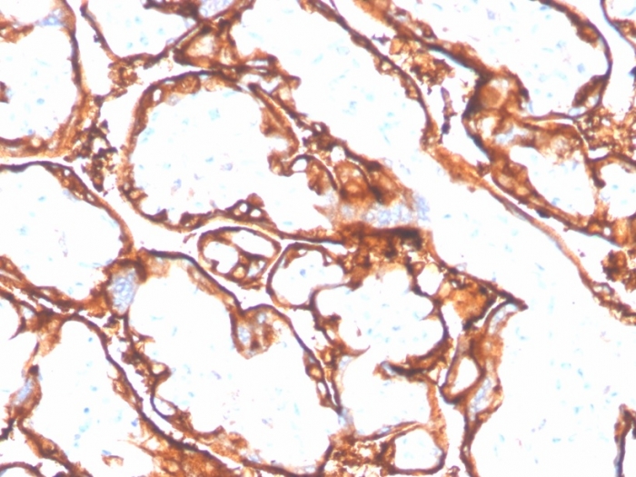 Anti-EGFR (mutated L858R) Antibody [GFR/4564R]