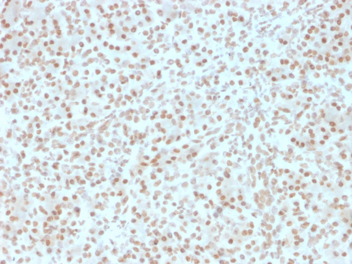 Anti-AKT1 Antibody [AKT1/2491]