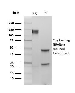 Anti-Estrogen Receptor beta 1 Antibody [PGP5/10]