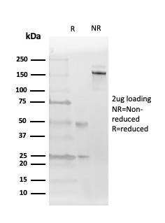 Anti-Estrogen Receptor beta 2 Antibody [57/3]