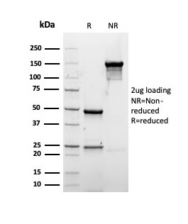 Anti-Albumin Antibody [rALB/6412]