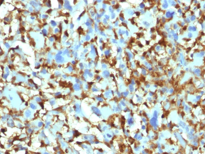 Anti-Factor XIIIa Antibody [F13A1/1448]