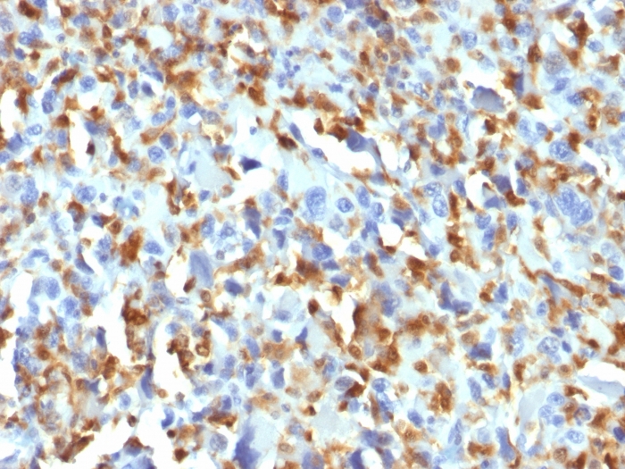 Anti-Factor XIIIa Antibody [F13A1/1683]