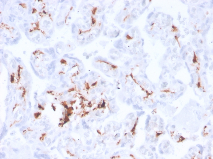 Anti-Factor XIIIa Antibody [F13A1/3772R]