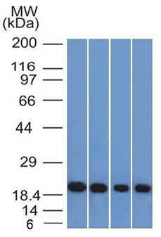 Anti-Ferritin Light Chain Antibody [FTL/1386]