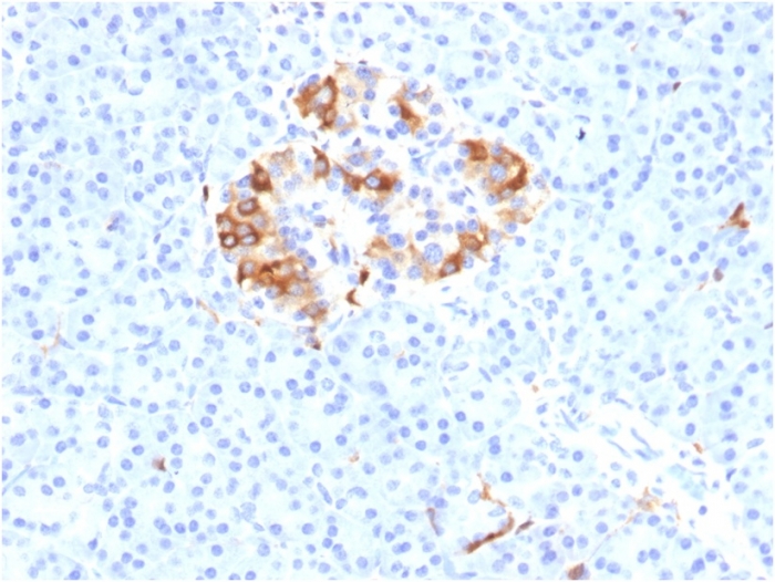 Anti-Ferritin Light Chain Antibody [FTL/1387]